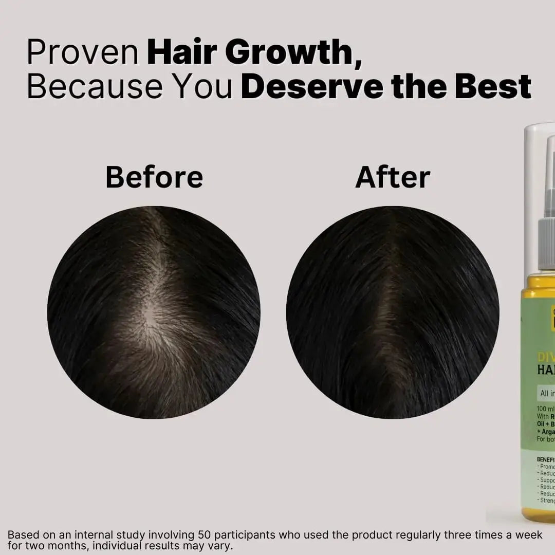 Divine Dew Hair Oil - Reduces Hair Fall, Dandruff & Promotes Hair Growth - Dazze and blussh